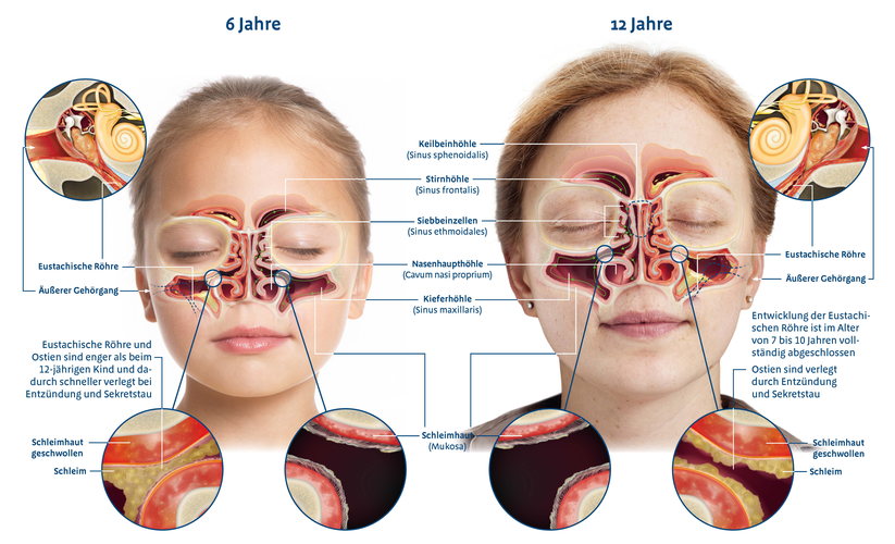 Anatomie der Nase (6 vs. 12 Jahre)